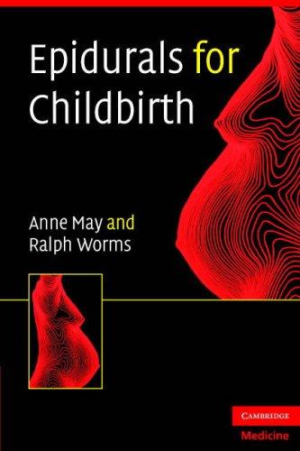 Cover of Epidurals for childbirth