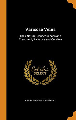 Cover of Varicose Veins