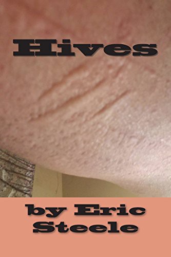 Cover of Hives