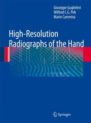 Cover of Highresolution Radiographs Of The Hand
