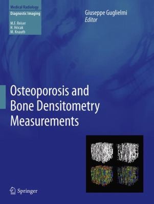 Cover of Osteoporosis And Bone Densitometry Measurements