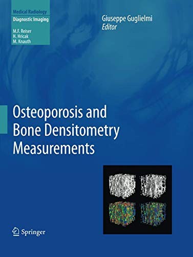 Cover of Osteoporosis and Bone Densitometry Measurements