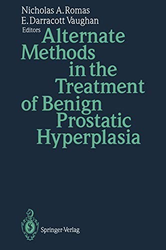 Cover of Alternate Methods in the Treatment of Benign Prostatic Hyperplasia